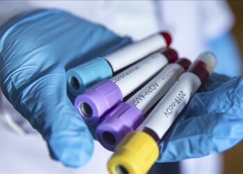 Crna Gora: Registrovano 476 novih slučajeva koronavirusa, preminule tri osobe