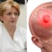 1 ČUDAN SIMPTOM UKAZUJE NA TUMOR! Dr Danica Grujičić otkrila znakove koji mogu otkriti da je bolest napala mozak