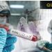 U Srbiji više vrsta gripa – korona, kašalj, stomačni, kod dece RSV virus