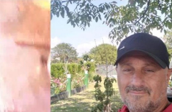 Ismet će 6. jun slaviti kao novi rođendan, preživeo udar groma na metar od njega