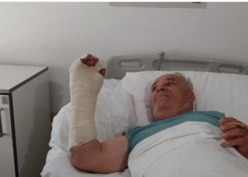 Lekari niškog Kliničkog centra uspeli da spasu desnu šaku čovjeku kojem je cikular isekao