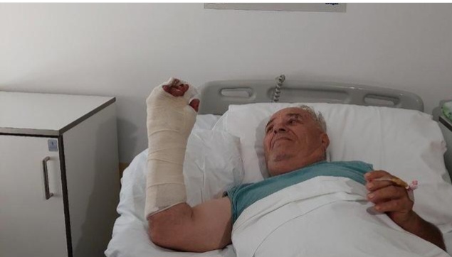 Lekari niškog Kliničkog centra uspeli da spasu desnu šaku čovjeku kojem je cikular isekao