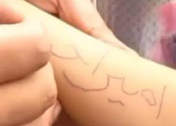 Žalosno šta djeca u Gazi proživljavaju, na ruci im ispisana imena iz jednog razloga