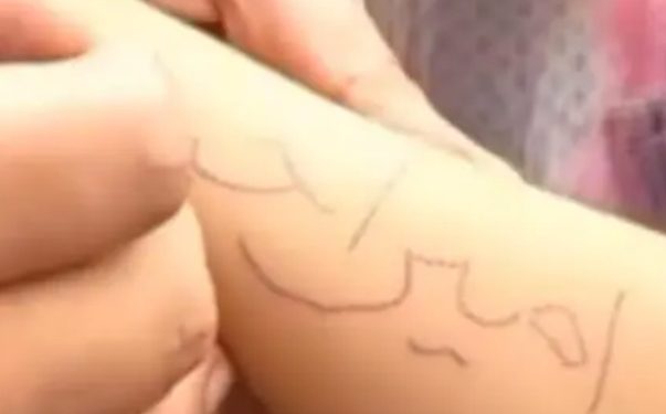 Žalosno šta djeca u Gazi proživljavaju, na ruci im ispisana imena iz jednog razloga