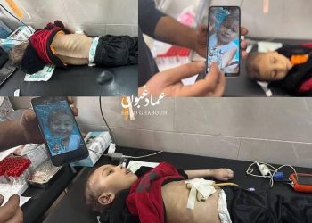 Dijete Mohammed Najjar (6) umrlo od gladi na sjeveru Gaze