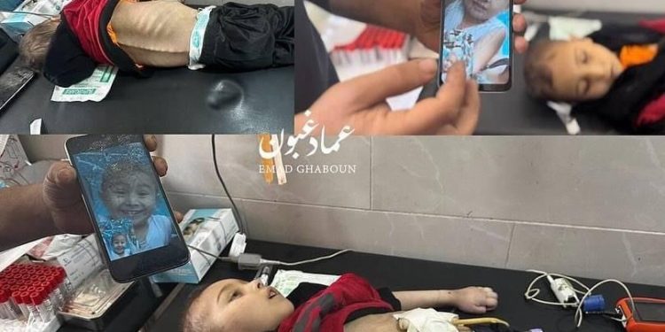 Dijete Mohammed Najjar (6) umrlo od gladi na sjeveru Gaze