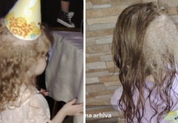 Ovoj maloj djevojčici raste tri vrste kose,  negdje je ravna a negdje u lokne