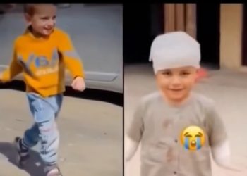 Palestinski dječak prije i poslije zločina cionističke izraelske vojske