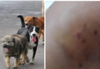 Psi lutalice siju strah u svim Sandžačkim opštinama, napali djevojčicu u dvorištu kuće
