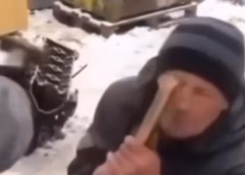 Kiropraktičar nasmijao region sa tehnikom namještanja nosa