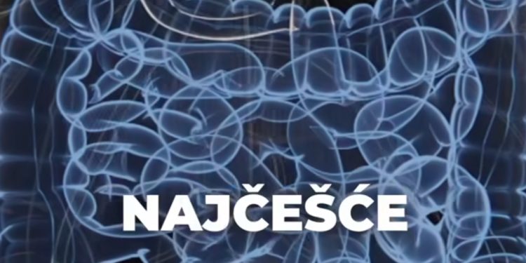 Karcinom debelog crijeva veliki uzročnik smrti, šta treba da znate