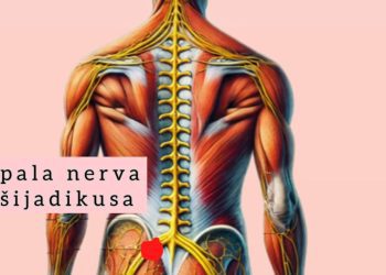 Bolovi u leđima: Sve češći problem diskus hernija i išijas, a evo šta kažu stručnjaci