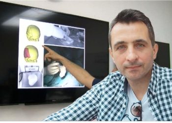 Dr. Anes Mašović: Sjenički genije koji pomiče granice neurohirurgije