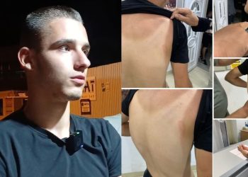 Brutalno prebijanje Benjamina Begovića (18) u Novom Pazaru: Slučaj koji traži odgovore
