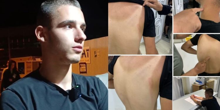 Brutalno prebijanje Benjamina Begovića (18) u Novom Pazaru: Slučaj koji traži odgovore