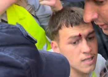 Hamza Zilkić ponovo povređen: Simbol studentske borbe i otpora  u Novom Pazaru