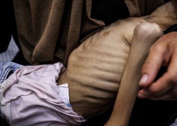 Glađu do smrti: Pet Palestinaca, uključujući troje djece, preminulo u Gazi od neuhranjenosti