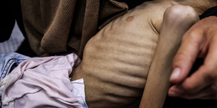 Glađu do smrti: Pet Palestinaca, uključujući troje djece, preminulo u Gazi od neuhranjenosti