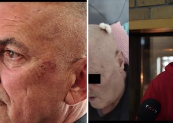 Navodi o teškom policijskom postupanju u Novom Pazaru: jedan muškarac u komi, drugi tvrdi da je pretučen