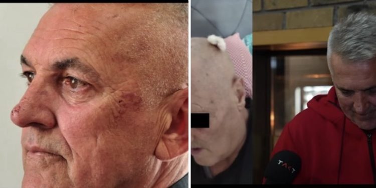 Navodi o teškom policijskom postupanju u Novom Pazaru: jedan muškarac u komi, drugi tvrdi da je pretučen