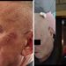 Navodi o teškom policijskom postupanju u Novom Pazaru: jedan muškarac u komi, drugi tvrdi da je pretučen