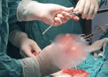 Komplikovana operacija Izalijana: kombinovana transplantacija bubrega i dejala jetre, otac donirao sinu