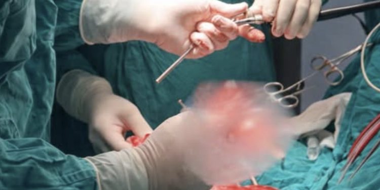 Komplikovana operacija Izalijana: kombinovana transplantacija bubrega i dejala jetre, otac donirao sinu