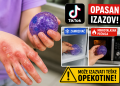 Opasan TikTok trend zabrinuo roditelje: Djeca zadobijaju teške opekotine zbog antistres igračke