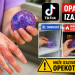 Opasan TikTok trend zabrinuo roditelje: Djeca zadobijaju teške opekotine zbog antistres igračke