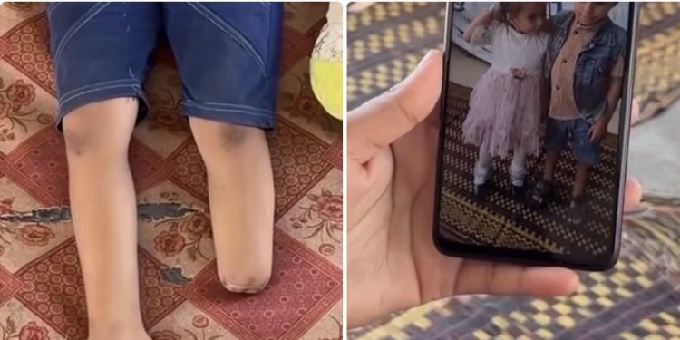 Četverogodišnja Jamalat iz Gaze gleda stare fotografije i traži svoju nogu